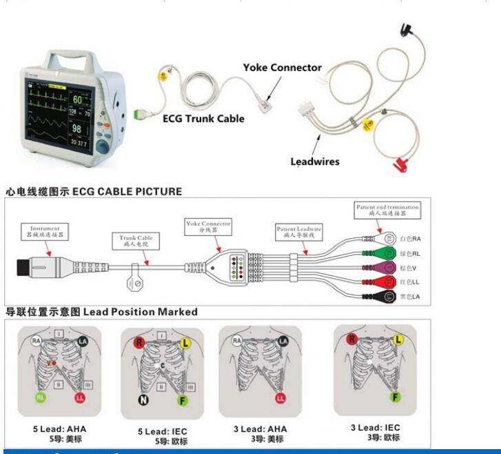 llun ecg