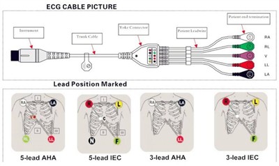 Sut i gysylltu cebl ECG â gwifrau plwm yn iawn â monitor claf?